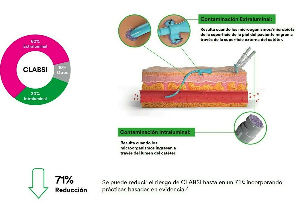 Image Alt Text
