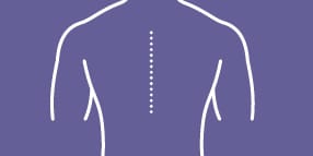 PREVENA™ Therapy
